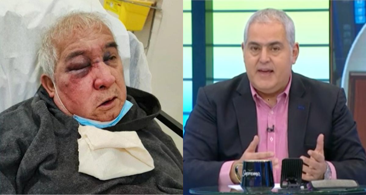 Conserje brutalmente golpeado y agresor sin prisión: Sabas Chahuán explicó con dura comparación