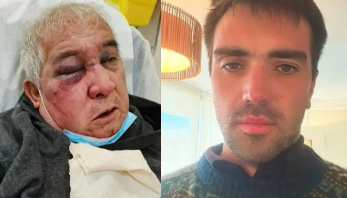 “Mi papá perdió un ojo y tú te haces la víctima”: el duro mensaje del hijo del conserje agredido en Vitacura